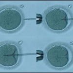 cyprus embryo donation