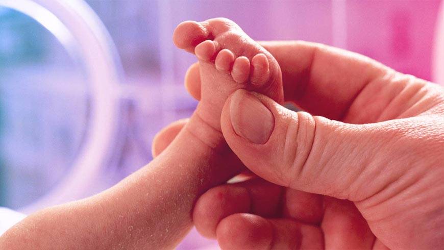 Premature Birth - Baby foot in one hand