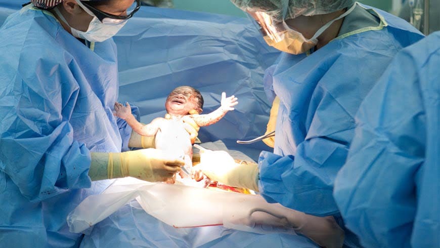 Natural birth or caesarean section