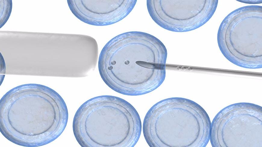 Cyprus egg donation and egg sharing